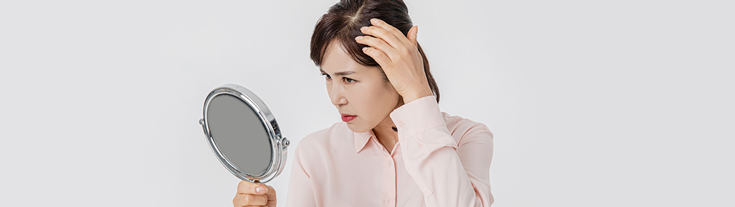 탈모 대표이미지