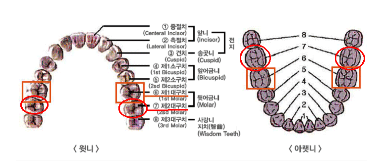 윗니, 아랫니 중 제1큰어금니 및 제2큰어금니 위치 설명